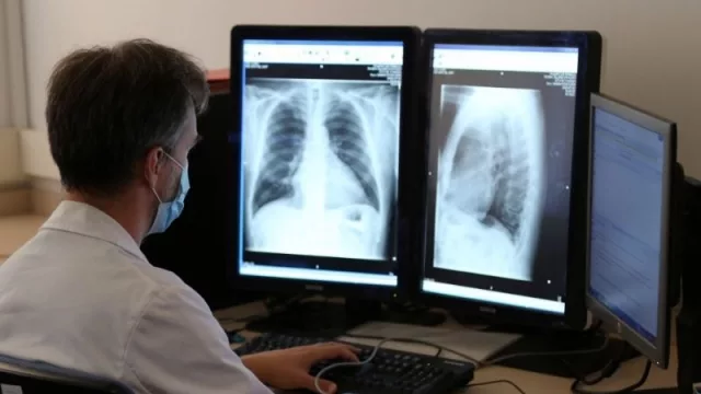 Visión artificial y machine learning para diagnósticos de salud, el tema de tesis de un nuevo ingeniero que nos brinda la universidad pública en Jujuy