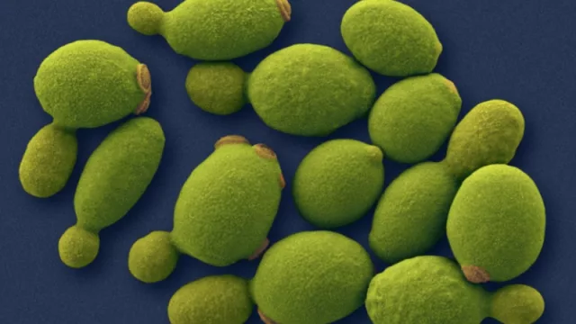 Una empresa francesa anunció inversión millonaria: quiere producir levadura Pichia